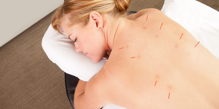 Professional Acupuncturist Using Books