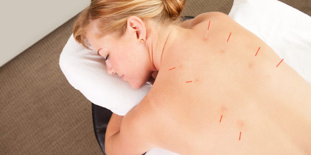 Professional Acupuncturist Using Books